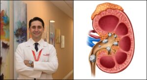 Böbrek Taşından Korunmak İçin 4 Önemli Öneri